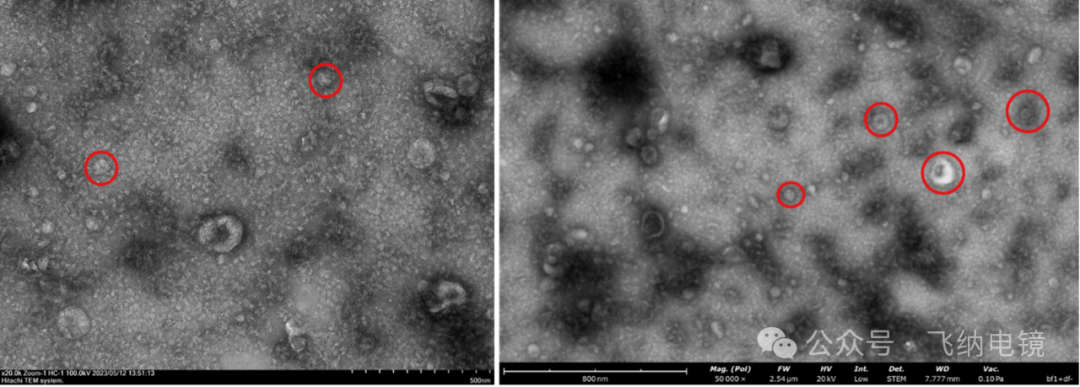 左：外泌體（TEM）；右：外泌體（Pharos STEM）