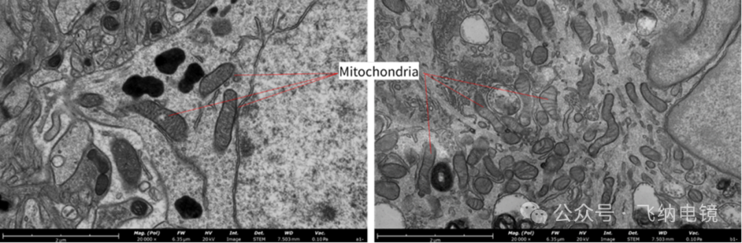 左：染色；右：未染色